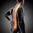 Ankylosing Spondylitis image 2