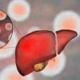Hepatitis C image 2