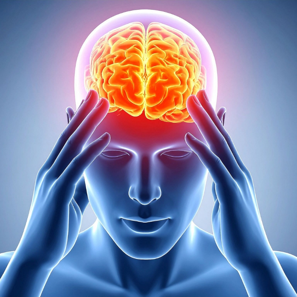 Migraine image 1