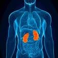 Nephrotic Syndrome image 2