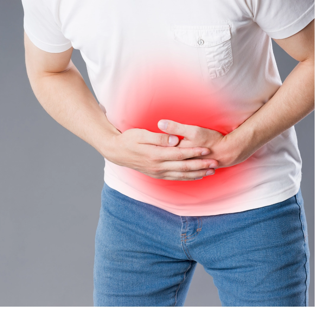 Ulcerative Colitis image 1