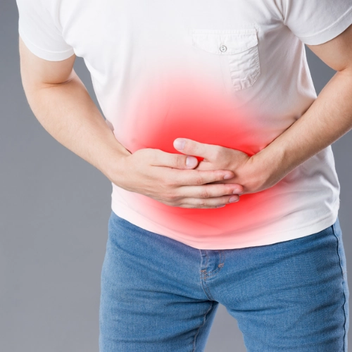 Ulcerative Colitis image 2